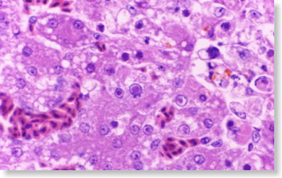 06 �A�f�m�E�B���X�����ǂ̊̑��g�D